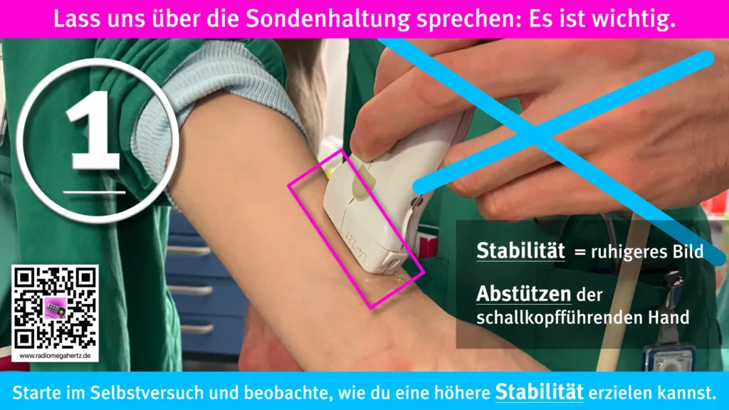 Ein ruhiges fast statisches B-Bild erzielst du besser, wenn du die Hand, die die Ultraschallsonde führt abstützt. Freizhändig ist das vermutlich nicht zu erzielen. Radiomegahertz.