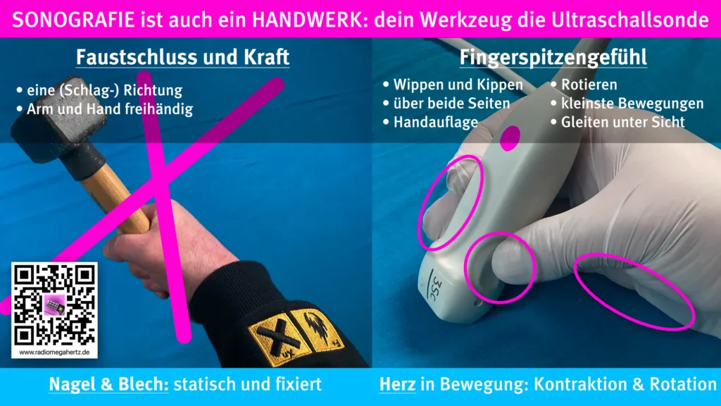 Um das schlagende Herz während der Kontraktion und Rotation sonografieren zu können, sind filigrane Sondenmanöver erforderlich. Die entsprechende TTE-Sondenhaltung mit den Finger hilft dir dabei. Radiomegahertz