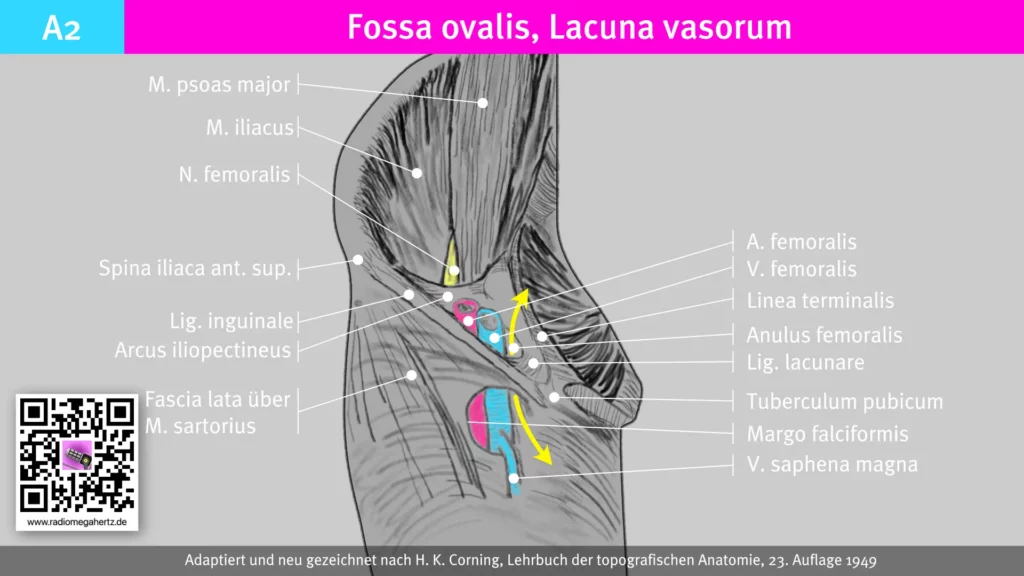 Der Canalis femoralis wird durch das dünne bindegewebige Septum femorale verschlossen. Radiomegahertz.